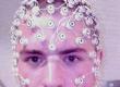 EEG Bio Feedback in Treating ADHD